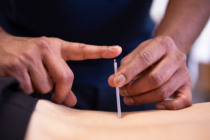 Acupuncture to reduce pain and inflammation in Chester