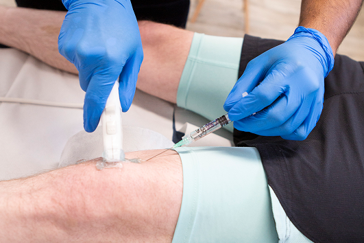 Knee osteoarthritis injection therapy