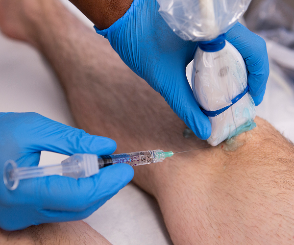 physiotherapy treatment for knee pain relief