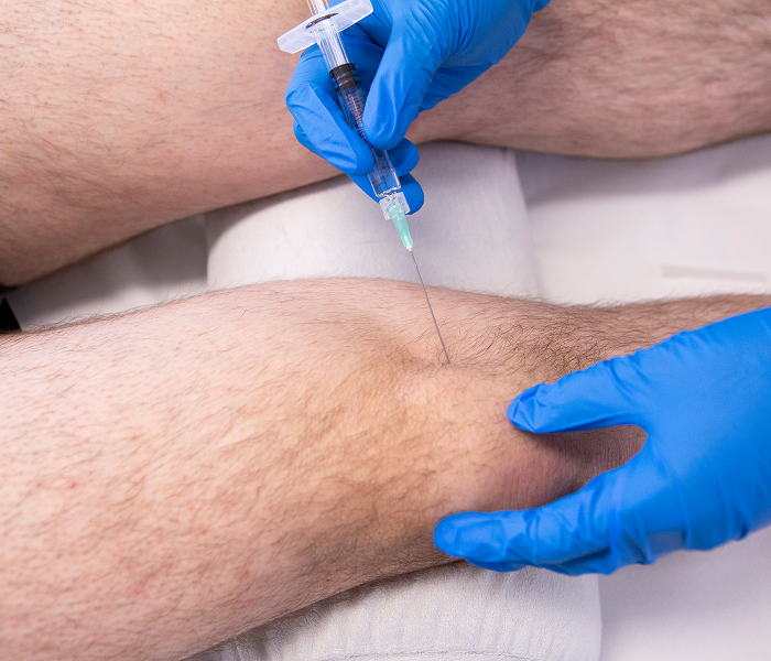 Physiotherapy treatment for osteoarthritis knee pain in Chester