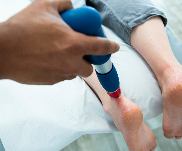 Shockwave therapy for Achilles tendonitis treatment in Chester