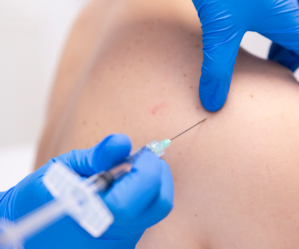 shoulder pain treatment from Chester physiotherapist