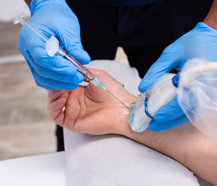 Ultrasound guided Durolane injection for the wrist