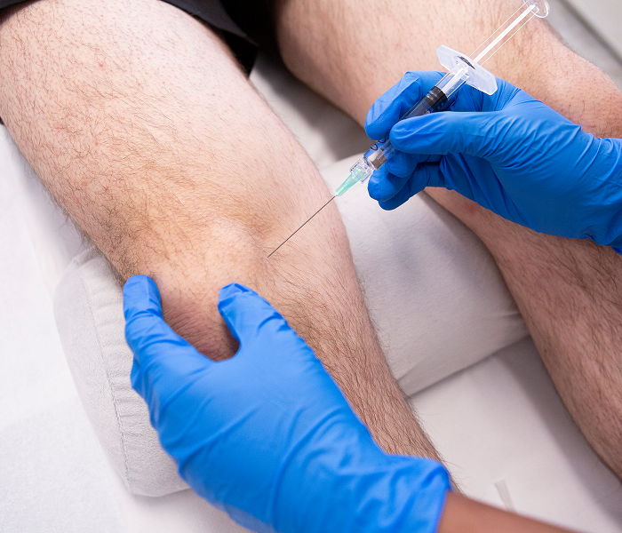 Ultrasound guided steroid injection for elbow pain in Chester